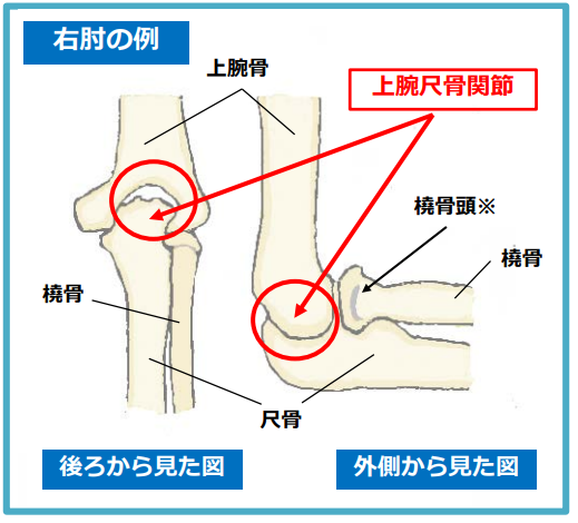 肘関節の人工関節そう入置換の取扱い」にご注意を！新横浜・川崎